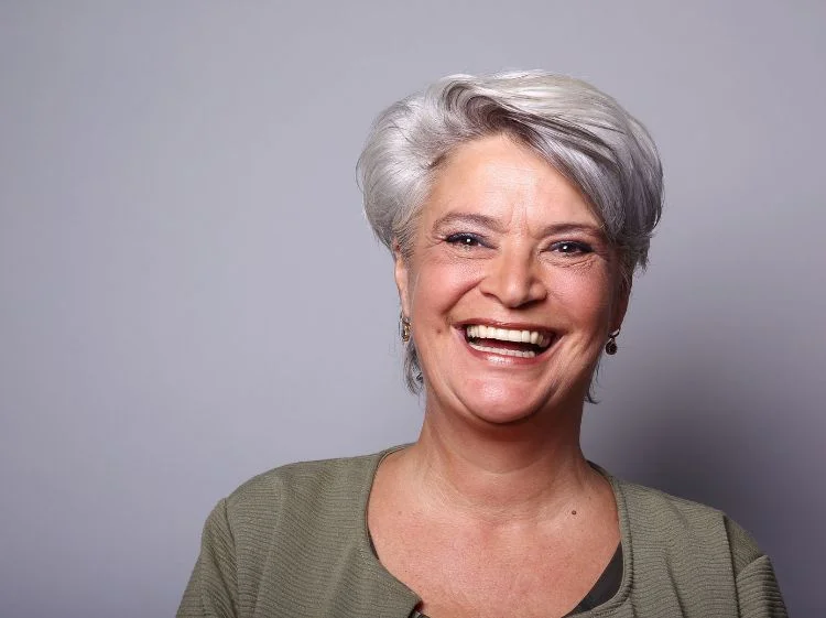 All-on-4-Dental-Implants-2
