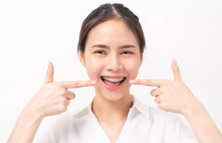 fitting fixed braces