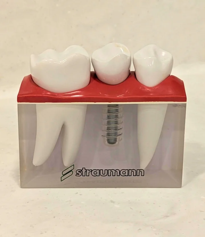 Single Tooth Implants