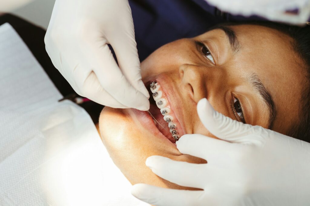 Dental Braces