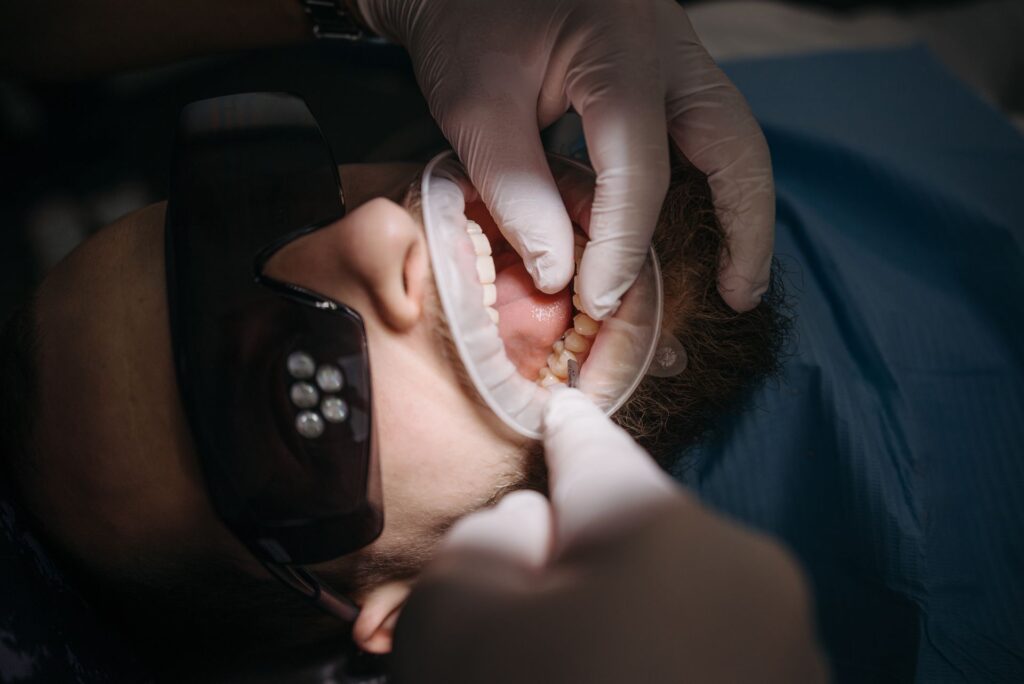 same day dental implant
