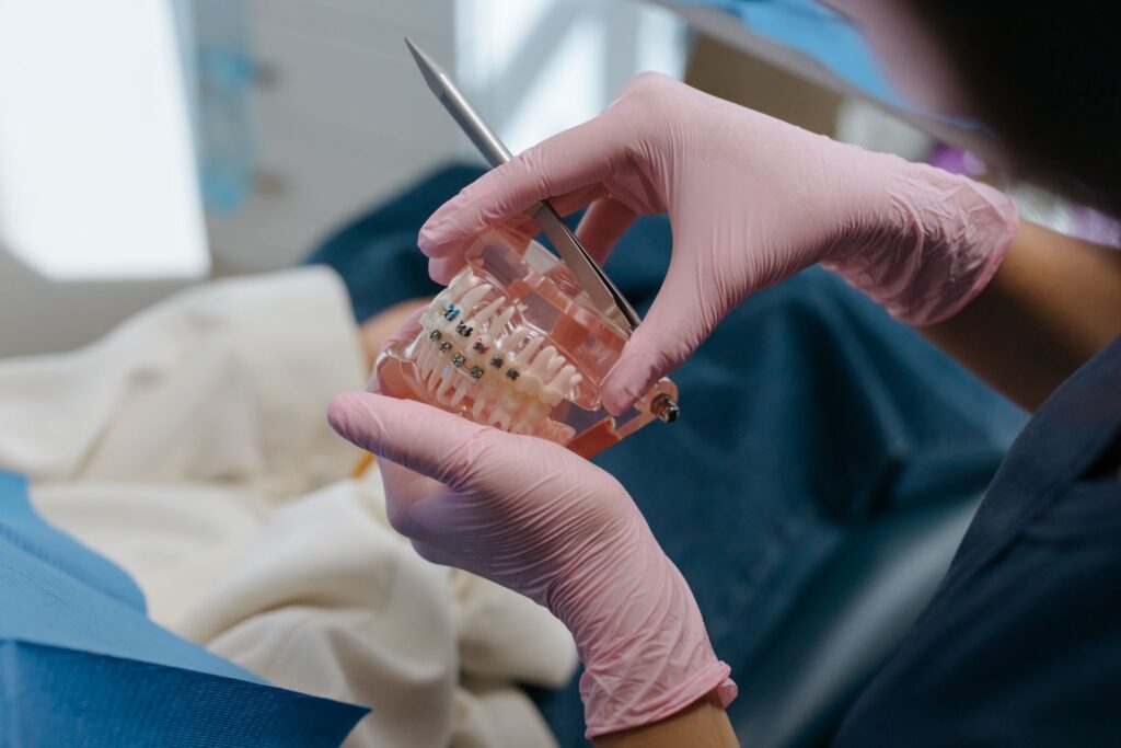 Braces Anxiety